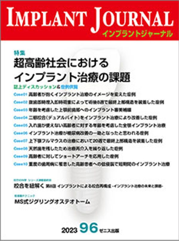 超高齢社会におけるインプラント治療の課題