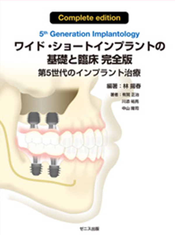ワイド・ショートインプラントの基礎と臨床 完全版